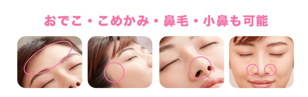 脱毛ラボ　口コミ