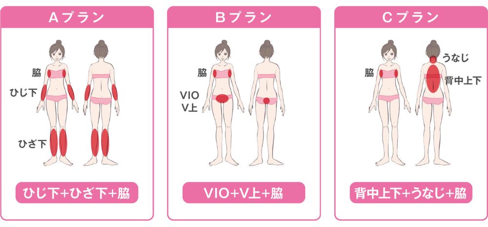脱毛ラボ　口コミ